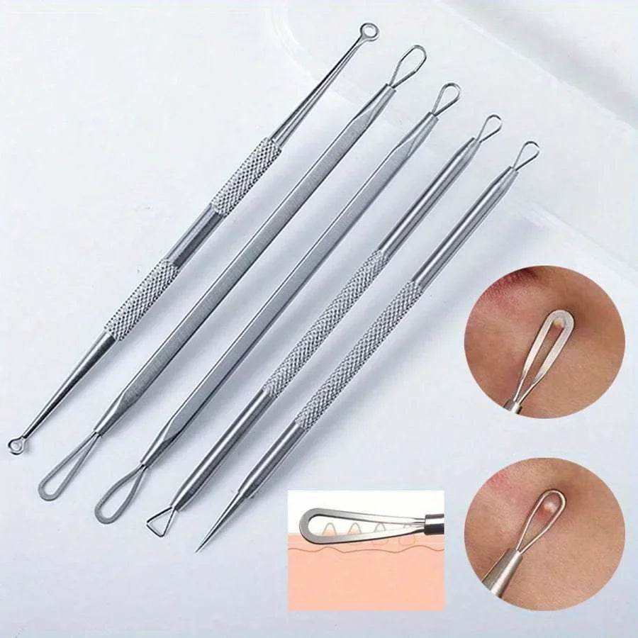 Blackhead Extractor Tool Kit Stainless Steel with Storage Box – image 2